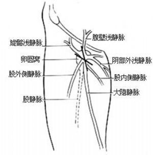 大腿根部卵圆窝解剖图图片