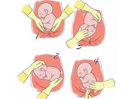 臀位转头位后胎动的变化