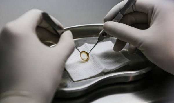 一个人的眼角膜可以救多少人