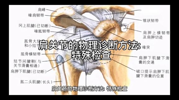 [图]肩关节的物理诊断方法之特殊检查