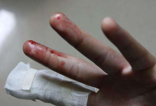 求一张手流血的照片,一定要逼真。谢了!