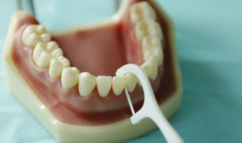 吃饭塞牙后,用牙签口牙好,还是用牙线剔牙好呢?