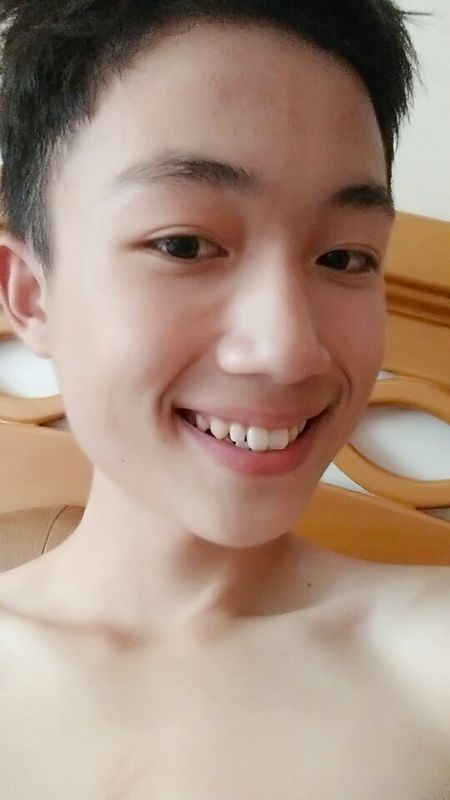 露牙笑很难看怎么办_360问答