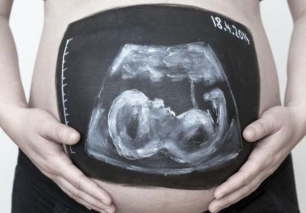 彩超和B超的区别是什么?