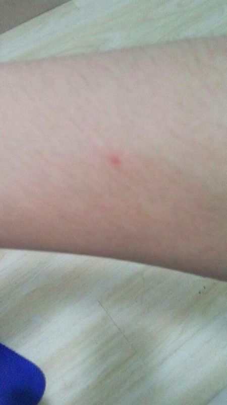 身上出现小红点,不痛不痒,刚开始只有胳膊上有,到现在上半身开始长了,能有半个月了,对人身体有害吗?