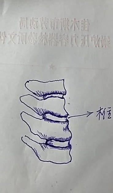 松腰落胯示意图讲解3