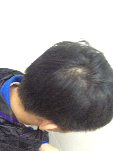 我头发有两个漩涡,但这是不是太明显了?是不是