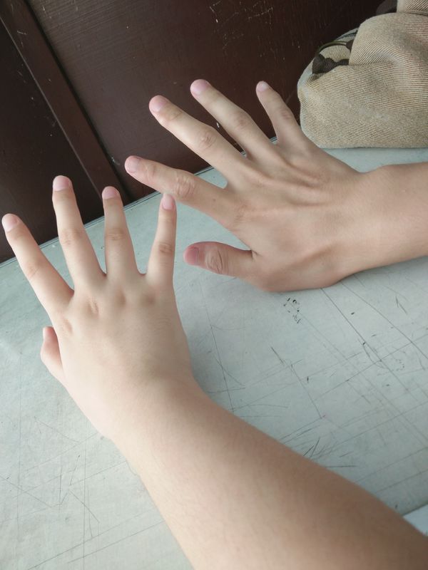 谁的手瘦?