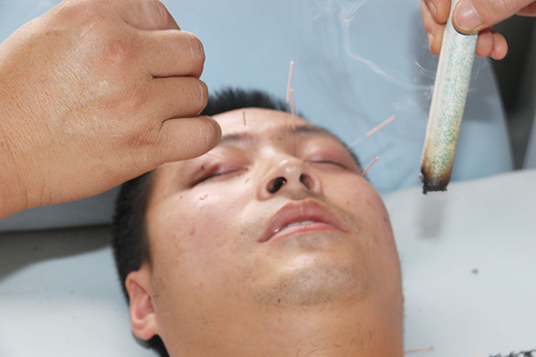 针灸可以治疗青光眼吗?