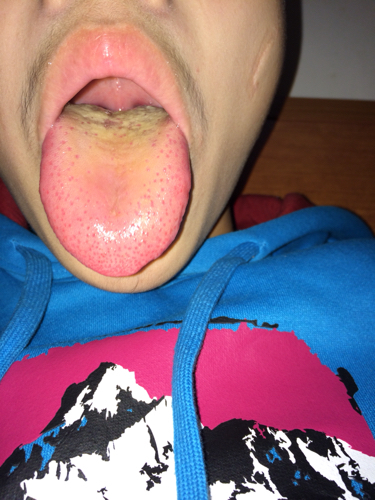 我舌头上有很多小红点是怎么回事