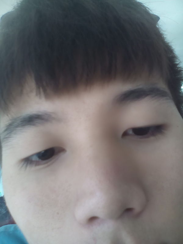 整鼻子有什么风险,大概要多长时间可以整好,价