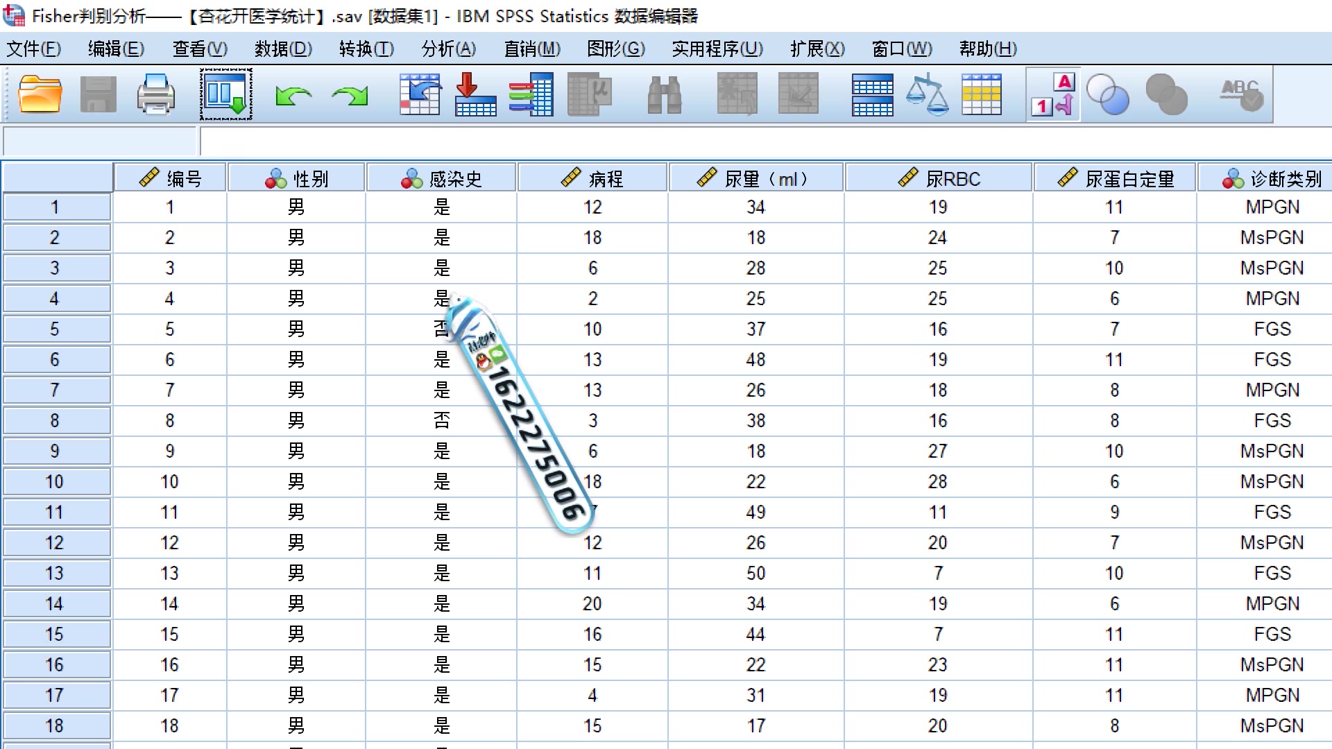 [图]在SPSS中进行Fisher判别分析的具体操作及研究意义——【杏花开医学统计】