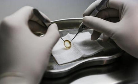 捐献的眼角膜有什么作用?