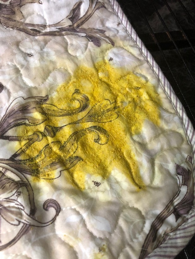 如图,近看像一滩稀释过的蛋黄本来中间还有一团人的头发,被我捡起来丢