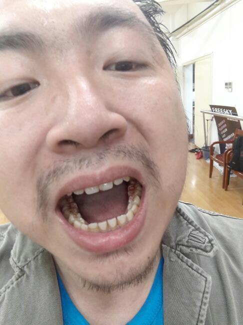 这是牙龈出血还是牙齿出血还是口腔出血?