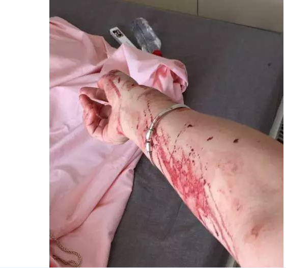 胳膊也到处是血