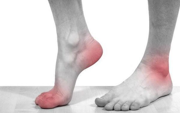 为何身体没外伤却常会膝盖痛呢?