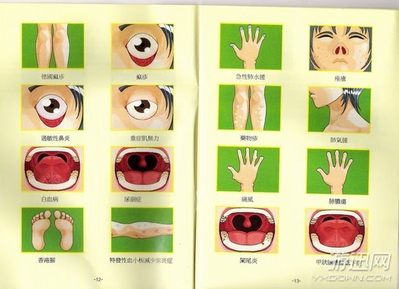 疯狂医院3怎么检查?各类疾病检查方法攻略