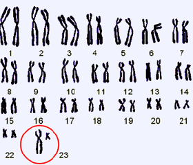 3x染色体女孩图片图片