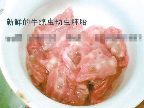 牛带绦虫的寄生部位