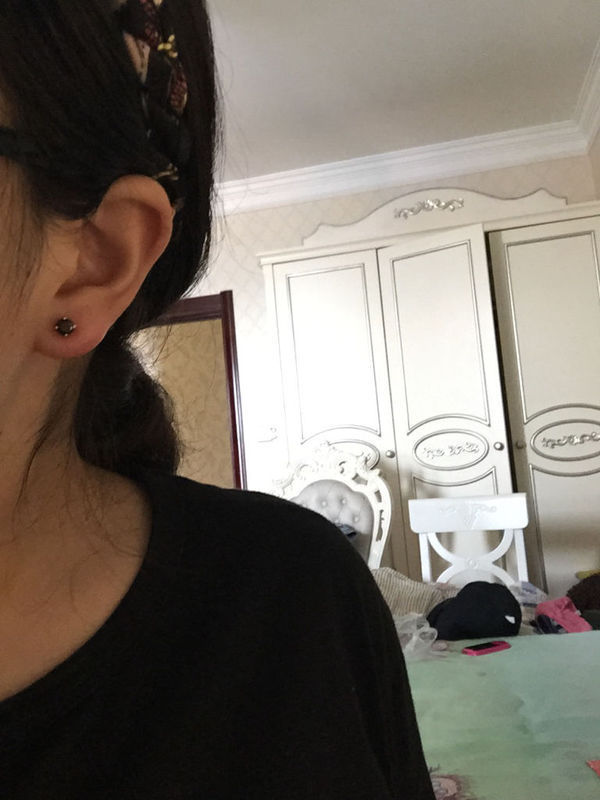 刚打完耳洞没保护好发炎了,第三天的时候我把