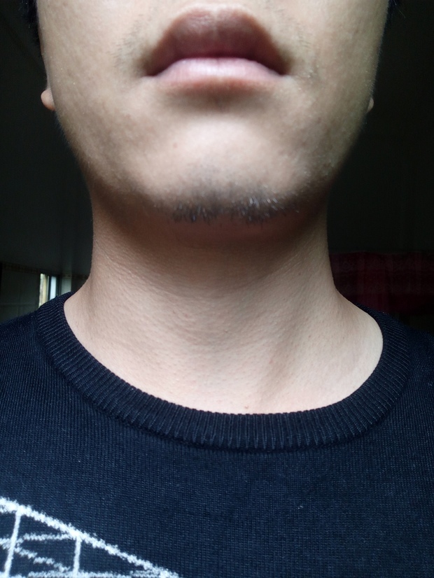 为什么我的胡子有好几根都是红色的?