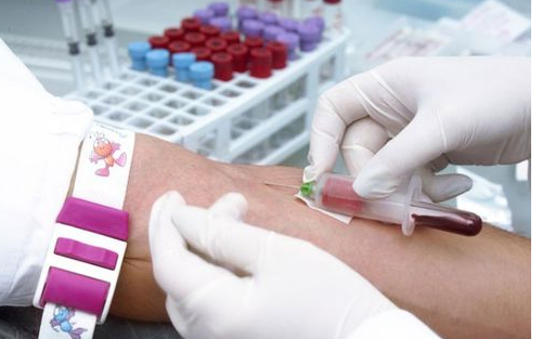 验兵的体检项目和标准要求是什么?