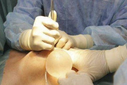 隆胸方法 目前主要有哪几种隆胸方法_360问答