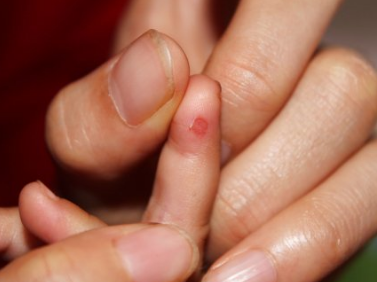 手受伤怎么发幽默的朋友圈