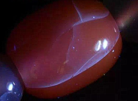 盐源玛瑙注胶与不注胶区别是什么?