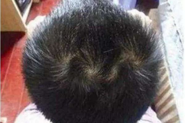 女孩头上两个旋好不好?