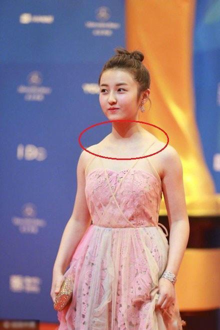 张子枫提名华鼎奖,穿礼服暴露硬伤,脖颈处咋了?_360问答