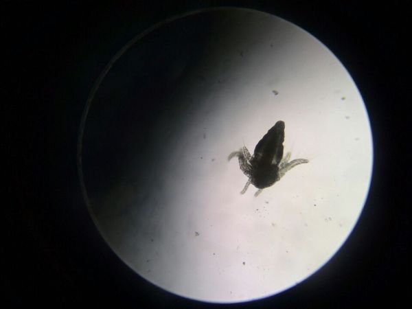看看吧,显微镜下的丰年虾,刚孵化的,还有孵化过程,挺有趣