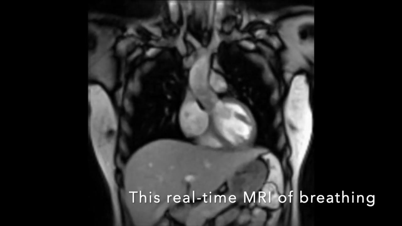 [图]呼吸实时MRI影像 Real-time MRI of Breathing