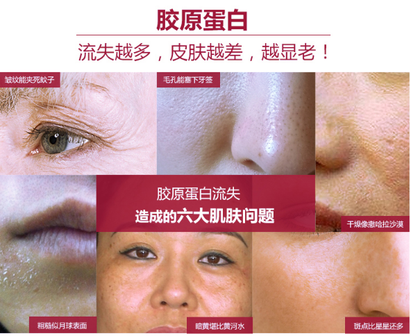 人体缺少胶原蛋白有哪些