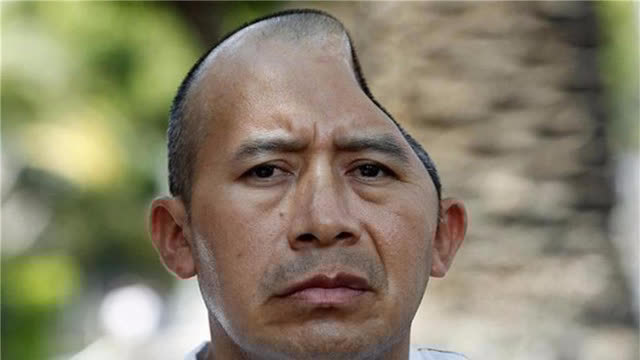 美国男子被保安打成" 半脑人" 获赔3.4亿,网友:不羡慕!