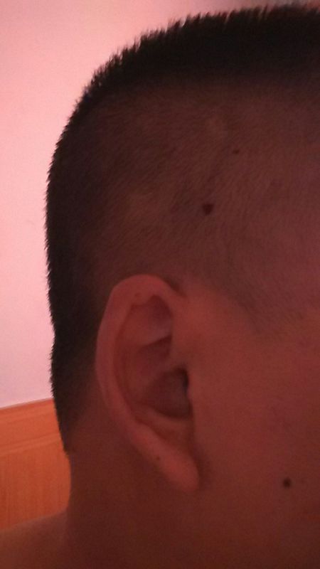 有没有大师帮我看看我耳朵形状是什么情况,两