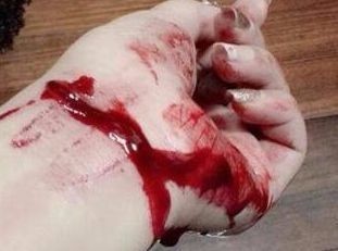 温州女子车内割腕自杀警察砸窗救人是怎么回事?