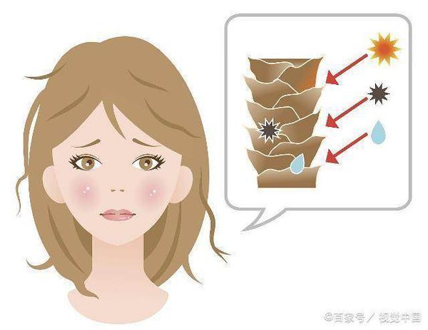 脸上有红血丝怎么办?