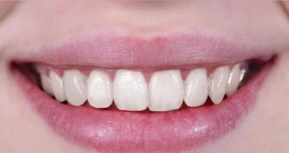 怎么用ps处理牙齿整齐 平整