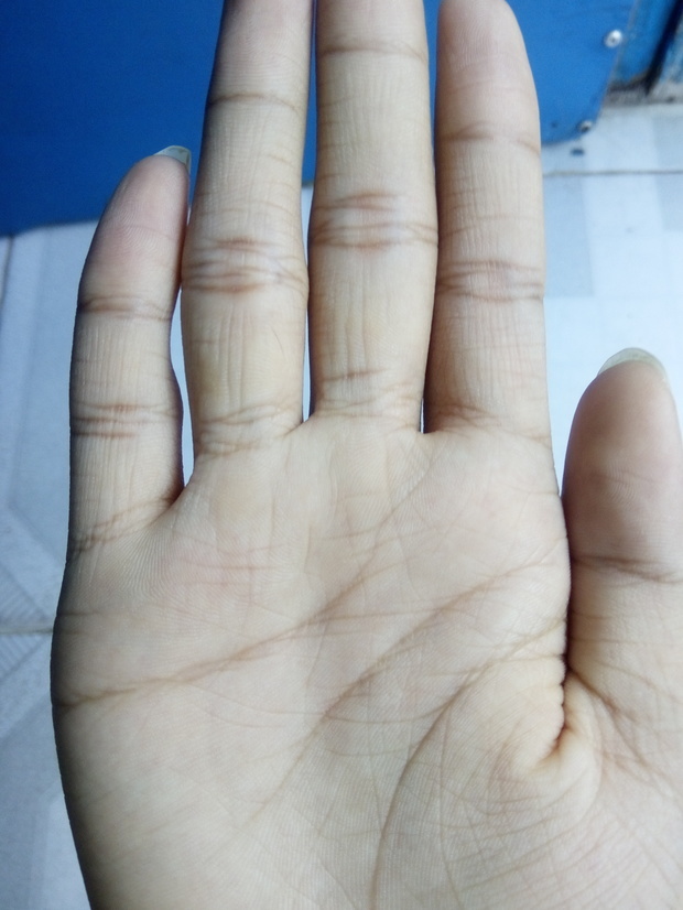 30 采纳率: 61%    等级: 41 已帮助: 22万人 手纹多说明缺乏维生素