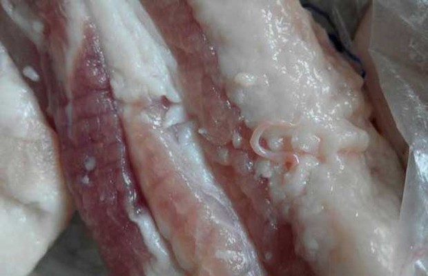 感染猪肉绦虫图片