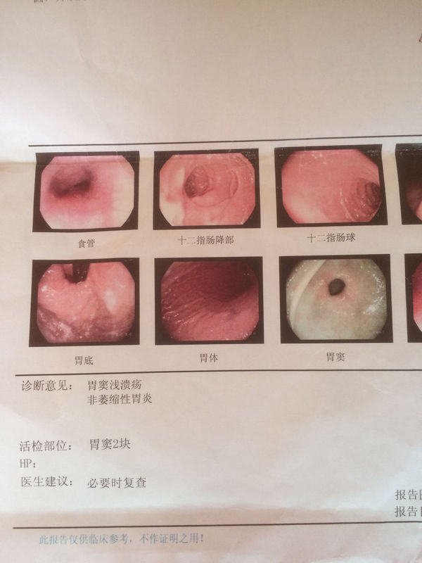 眼睛瘙痒与疼痛：常见原因及应对措施