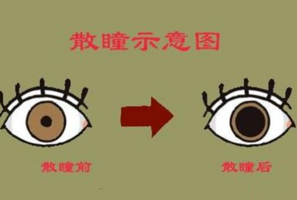 散瞳是干什么的