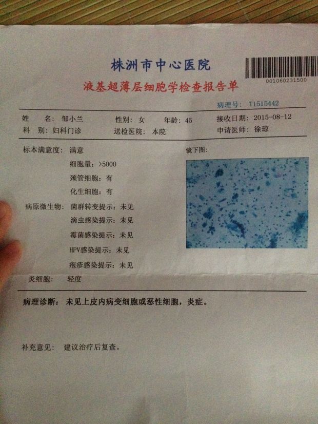 女人感染hpv52图片图片