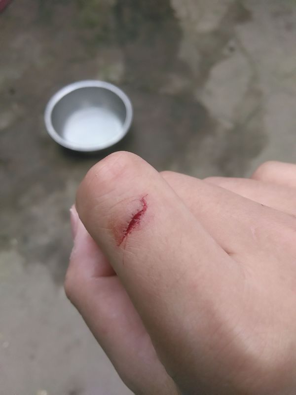 我的手破了一个口子,当是飚血不止,纸巾刚贴上