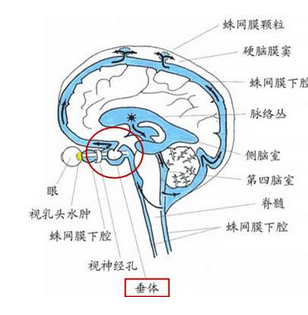 脑脊液鼻漏是什么病?