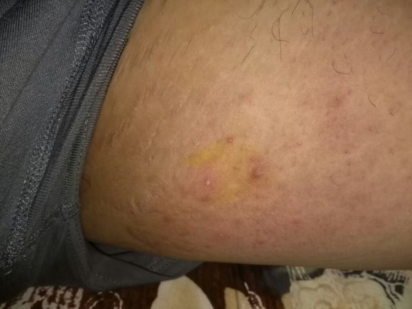 胖,减肥每天走哭路走很远。走远了大腿内侧摩