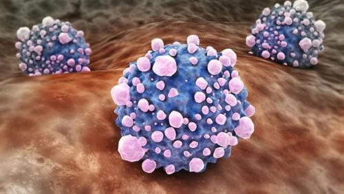 恶性肿瘤的主要表现是什么?