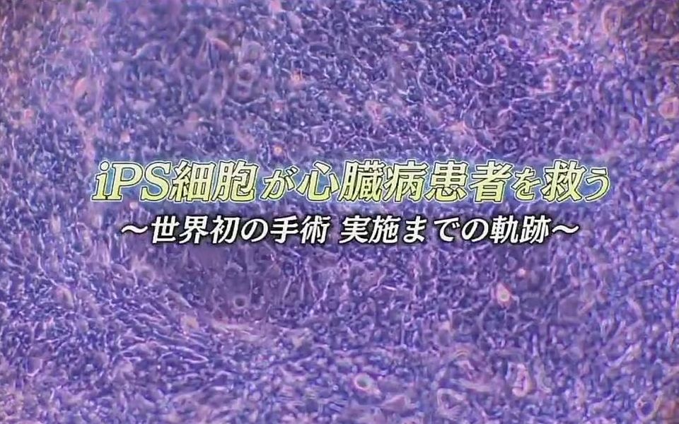 [图]【日语学习】NHK 拯救心脏病患者的IPS细胞